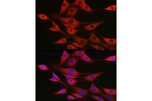 Immunofluorescence analysis of NIH/3T3 cells using SSR2 Rabbit pAb (ABIN7270299) at dilution of 1:100 (40x lens).