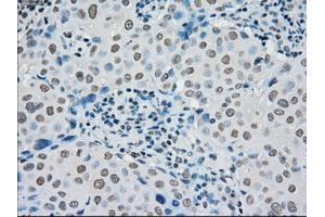 Image no. 2 for anti-Premelanosome Protein (PMEL) antibody (ABIN1500300)