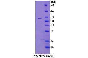 SDS-PAGE analysis of Human FIBP Protein. (FIBP Protéine)