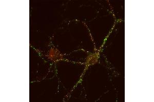 Indirect immunolabeling of PFA fixed rat hippocampus neurons with anti-synapsin 3 (1 : 500; red) and mouse anti-synapsin 1 (, dilution 1 : 500; green) (Synapsin III anticorps  (AA 417-434))