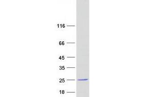 Validation with Western Blot