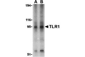 Western Blotting (WB) image for anti-Toll-Like Receptor 1 (TLR1) (Middle Region) antibody (ABIN1031127) (TLR1 anticorps  (Middle Region))