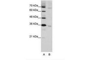 Image no. 1 for anti-Wingless-Type MMTV Integration Site Family, Member 5B (WNT5B) (C-Term) antibody (ABIN203075)