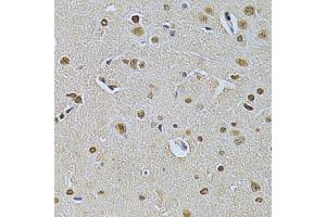 Immunohistochemistry of paraffin-embedded rat brain using ILK Antibody. (ILK anticorps  (AA 1-260))
