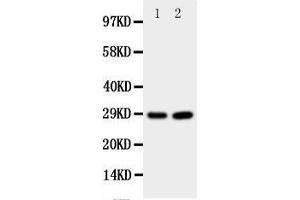 Western Blotting (WB) image for anti-Prion Protein (PRNP) (AA 143-159), (Middle Region) antibody (ABIN3044180) (PRNP anticorps  (Middle Region))