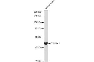 Western blot analysis of extracts of Mouse testis, using CYP11 antibody (6363) at 1:1000 dilution. (CYP11A1 anticorps  (AA 40-320))
