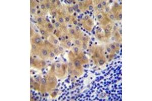 Formalin fixed and paraffin embedded human liver tissue reacted with GGH Antibody (C-term) followed by peroxidase conjugation of the secondary antibody and DAB staining.