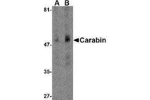 Western Blotting (WB) image for anti-TBC1 Domain Family, Member 10C (TBC1D10C) (N-Term) antibody (ABIN1031291)