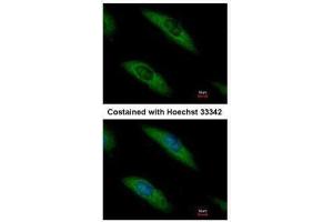 ICC/IF Image Immunofluorescence analysis of methanol-fixed HeLa, using Aldolase B, antibody at 1:500 dilution.