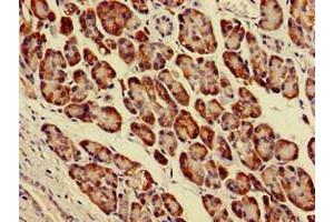 Immunohistochemistry of paraffin-embedded human pancreatic tissue using ABIN7143927 at dilution of 1:100 (Parvin alpha anticorps  (AA 2-94))