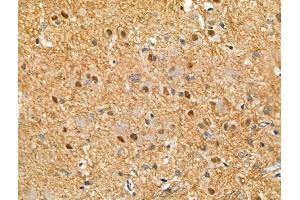 Phospho-SALL1 (Ser941) Antibody at 1/100 staining Rat brain tissue by IHC-P. (SALL1 anticorps  (pSer941))