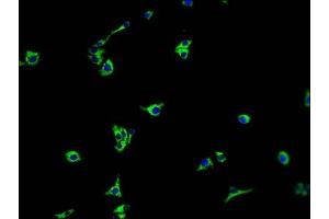 Immunofluorescence staining of HepG2 cells with ABIN7140231 at 1:100, counter-stained with DAPI. (TMEM37 anticorps  (AA 4-20))
