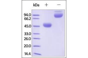 SDS-PAGE (SDS) image for Cytotoxic T-Lymphocyte-Associated Protein 4 (CTLA4) (AA 37-160) (Active) protein (Fc Tag) (ABIN2180932)