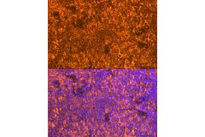 Immunofluorescence analysis of Mouse spleen using FB antibody (ABIN6129339, ABIN6140465, ABIN6140466 and ABIN6224941) at dilution of 1:100. (FAM65B anticorps  (AA 1-210))