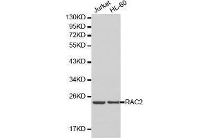 Western blot analysis of Jurkat cell and HL-60 cell lysate using RAC2 antibody. (RAC2 anticorps  (AA 1-192))
