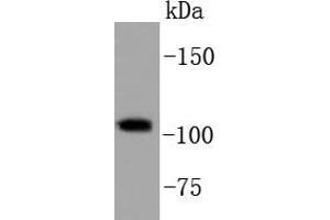 HeLa cell lysates, probed with PI3-kinase p110 subunit beta (34F12) Monoclonal Antibody  at 1:1000 overnight at 4˚C. (PIK3CB anticorps)