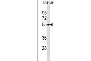 LRRIQ4 Antibody (N-term) (ABIN1538898 and ABIN2838169) western blot analysis in Uterus tissue lysates (35 μg/lane). (LRRIQ4 anticorps  (N-Term))
