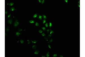 Immunofluorescence staining of Hela cells with ABIN7153753 at 1:100, counter-stained with DAPI. (SIP1 anticorps  (AA 1-280))