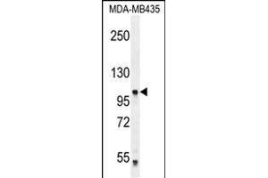 PCDHA5 Antibody (Center) (ABIN655942 and ABIN2845331) western blot analysis in MDA-M cell line lysates (35 μg/lane). (PCDHA5 anticorps  (AA 287-315))
