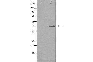 Western blot analysis of extracts from COLO205 cells, using GLR antibody. (Glucagon Receptor anticorps  (Internal Region))