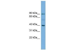 HFE antibody used at 1 ug/ml to detect target protein. (HFE anticorps  (N-Term))