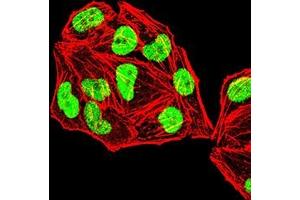 Immunofluorescence analysis of Hela cells using MSH2 mouse mAb (green).