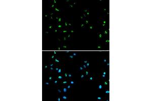 Immunofluorescence analysis of A549 cells using HDAC4 antibody (ABIN5970069). (HDAC4 anticorps)