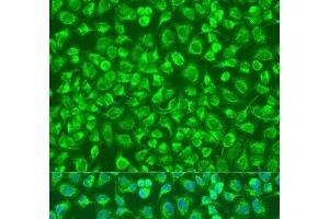 Immunofluorescence analysis of U2OS cells using ENTPD5 Polyclonal Antibody at dilution of 1:100. (ENTPD5 anticorps)