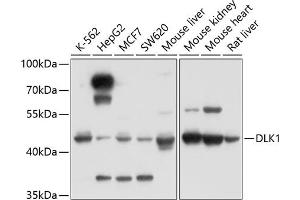 Western blot analysis of extracts of various cell lines, using DLK1 antibody (ABIN3016512, ABIN3016513, ABIN3016514 and ABIN6219768) at 1:1000 dilution. (DLK1 anticorps)