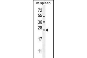 LMO4 Antibody (Center) (ABIN654714 and ABIN2844403) western blot analysis in mouse spleen tissue lysates (35 μg/lane). (LMO4 anticorps  (AA 104-131))