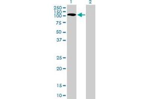 Western Blot analysis of PKN1 expression in transfected 293T cell line by PKN1 monoclonal antibody (M01), clone 1B10.