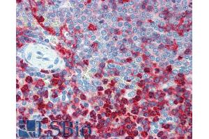 Immunohistochemistry staining of human spleen (paraffin sections) using anti-CD18 (Commercially tested by LifeSpan BioSciences.