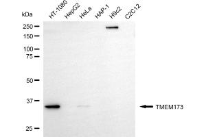 Western blotting analysis using TMEM173 antibody (ABIN7800620).