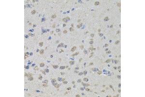 Immunohistochemistry of paraffin-embedded mouse brain using MAPK1 antibody.