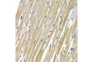 Immunohistochemistry of paraffin-embedded rat heart using GPD1 Antibody.