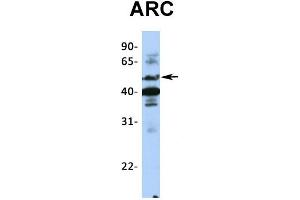 Host:  Rabbit  Target Name:  ARC  Sample Type:  Hela  Antibody Dilution:  1.