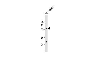 Anti-CARS2 Antibody (C-term) at 1:1000 dilution + NCI- whole cell lysate Lysates/proteins at 20 μg per lane. (CARS2 anticorps  (C-Term))