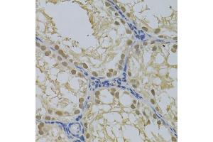 Immunohistochemistry of paraffin-embedded rat testis using DNMT3A Antibody (ABIN1872325) at dilution of 1:100 (40x lens). (DNMT3A anticorps)