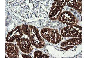 Image no. 3 for anti-butyrobetaine (Gamma), 2-Oxoglutarate Dioxygenase (Gamma-butyrobetaine Hydroxylase) 1 (BBOX1) antibody (ABIN1496819)