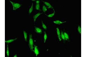 Immunofluorescent analysis of Hela cells using ABIN7169756 at dilution of 1:100 and Alexa Fluor 488-congugated AffiniPure Goat Anti-Rabbit IgG(H+L)