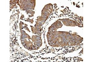 IHC analysis of TAB2 using anti-TAB2 antibody (ABIN7600244). (TAB2 anticorps  (AA 169-522))