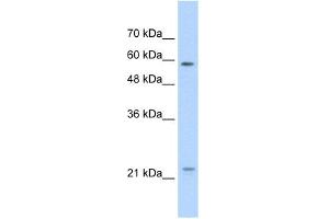 WB Suggested Anti-CAV1 Antibody Titration:  1. (Caveolin-1 anticorps  (N-Term))