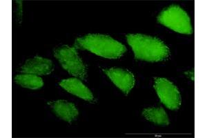 Immunofluorescence of purified MaxPab antibody to CASP3 on HeLa cell.