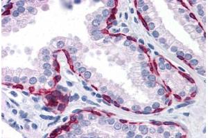 Human Prostate: Formalin-Fixed, Paraffin-Embedded (FFPE) (KRT81 anticorps  (AA 1-203))