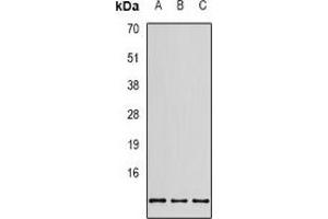Western blot analysis of RPS20 expression in SHSY5Y (A), MCF7 (B), HEK293T (C) whole cell lysates. (RPS20 anticorps)