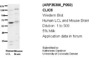 Image no. 2 for anti-Chloride Intracellular Channel 6 (CLIC6) (Middle Region) antibody (ABIN2776271)