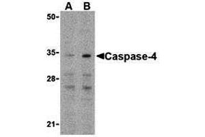 Western Blotting (WB) image for anti-Caspase 4, Apoptosis-Related Cysteine Peptidase (CASP4) (N-Term) antibody (ABIN1031297)