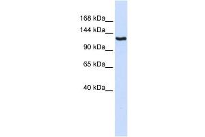 IGSF1 antibody used at 1 ug/ml to detect target protein.