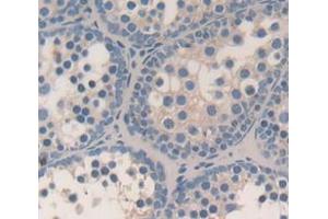 Used in DAB staining on fromalin fixed paraffin- embedded Kidney tissue (Inhibin alpha anticorps  (AA 240-366))