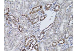 Immunohistochemistry of paraffin-embedded mouse kidney using ITGAV antibody (ABIN1873308) at dilution of 1:50 (40x lens). (CD51 anticorps)